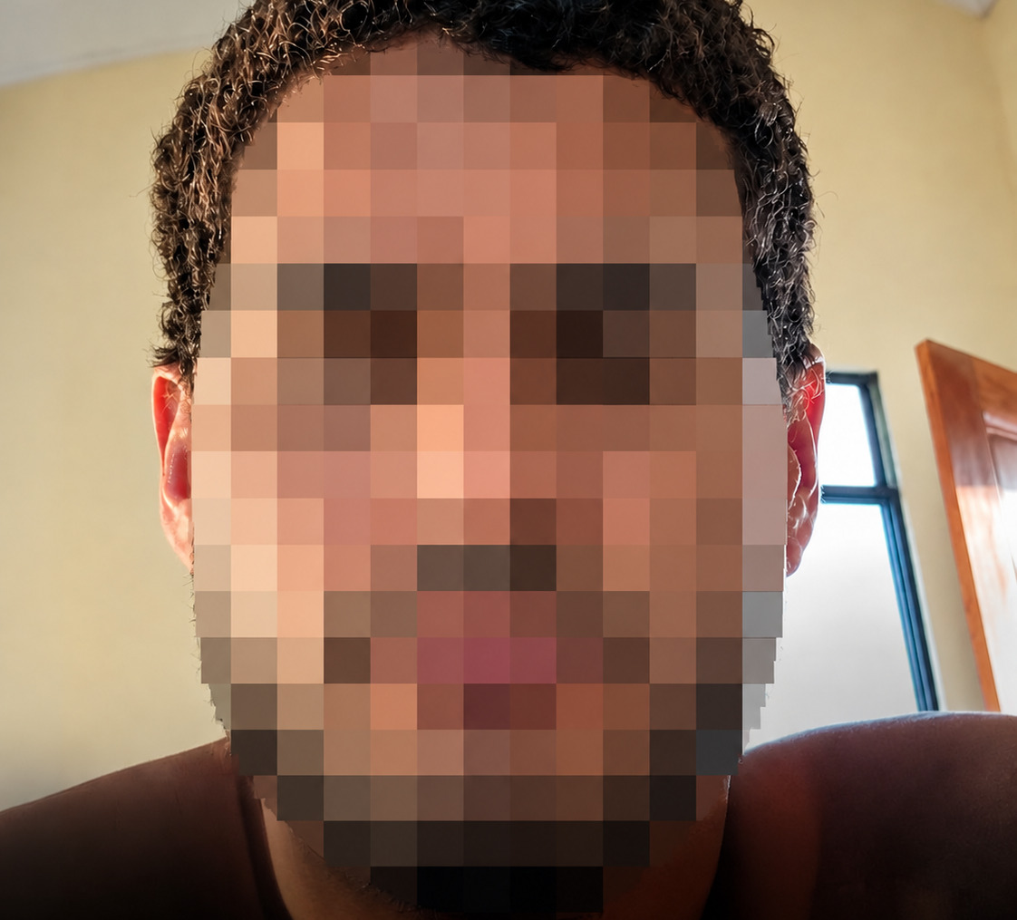 Brasileiro morre em hospital na Bolívia após ser baleado durante ação policial em Cobija